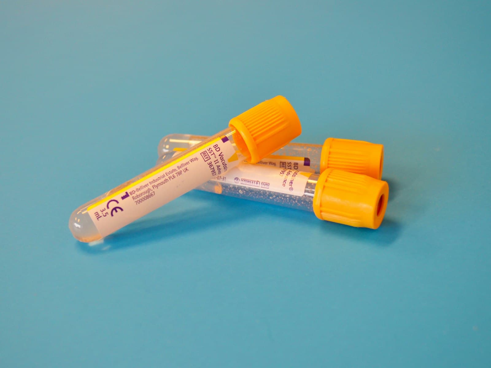 Blood sample vials prepared for laboratory testing